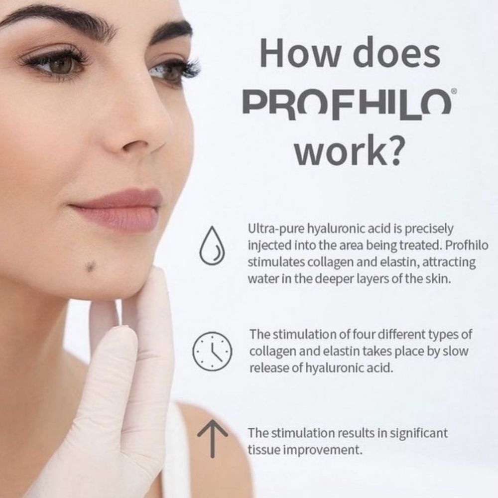 Profhilo