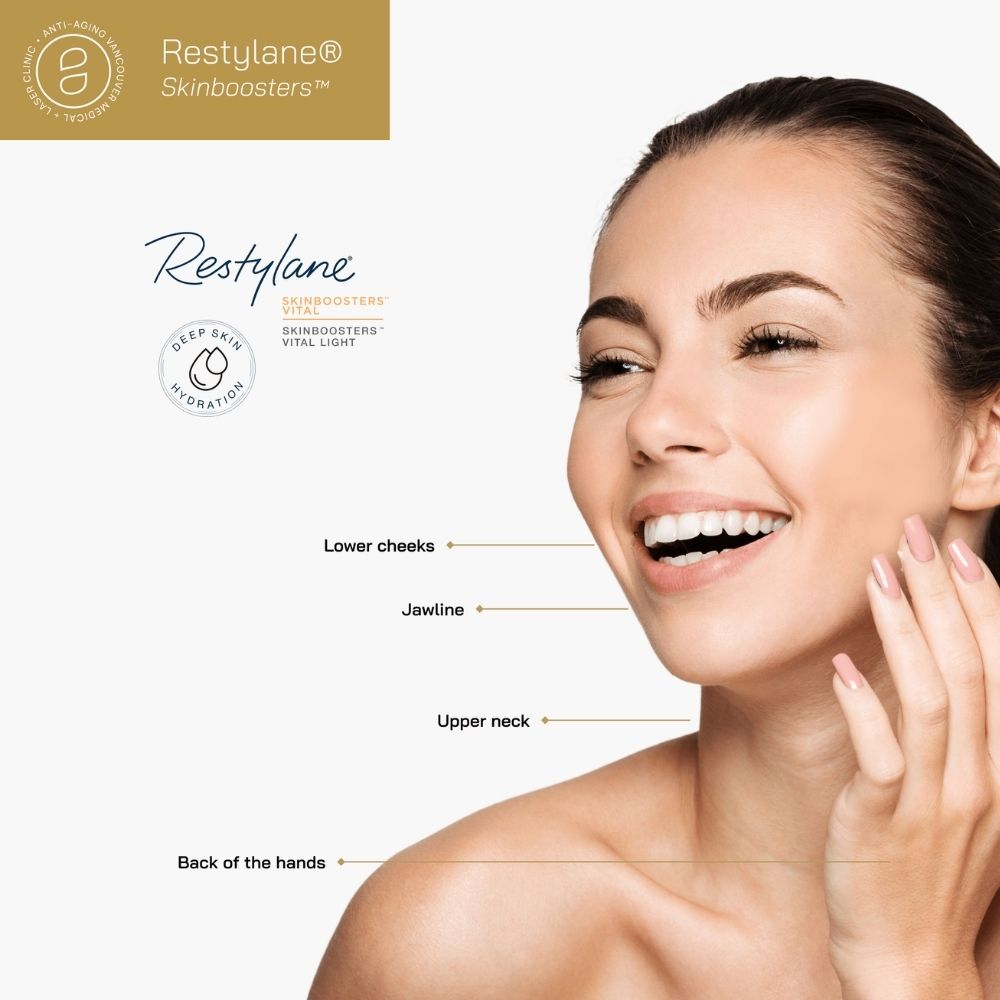 Restylane Skinbooster